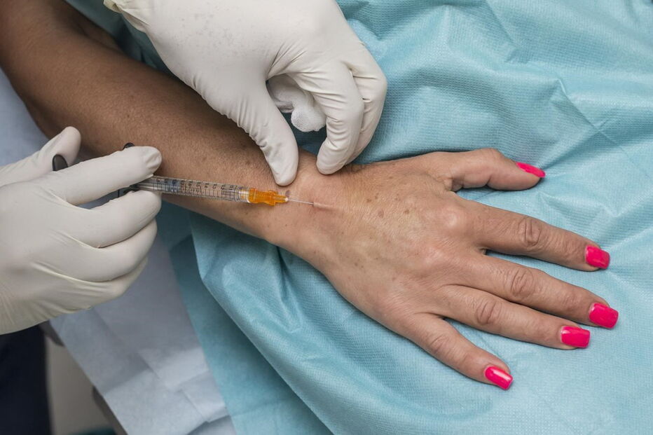 Peeling é aplicação de um produto na mão que vai eliminar as manchas 