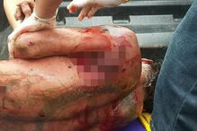Homem atacado por urso
