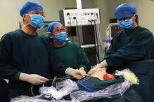 Man boobs, ginecomastia