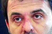 Nuno Barreto, adjunto do Governo 