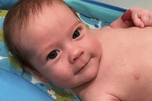 Casal foi obrigado a sacrificar gémeos siameses para salvar o filho, Thomas