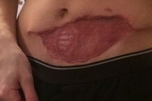 Antony teve que ser sujeito a uma série de operações nos últimos 12 meses