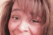 Lisa detetou uma mancha escura na unha da cliente