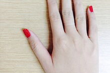 Lisa detetou uma mancha escura na unha da cliente