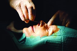 A cirurgia de correção do nariz pode demorar menos de 30 minutos 