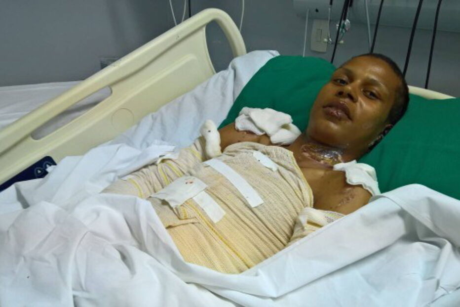 travesti, rio de janeiro, brasil, queimado, queimaduras, homicídio, mulher, crime