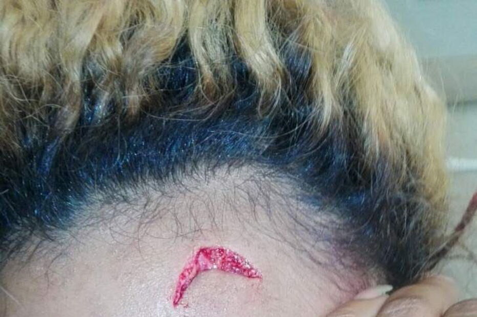 Modelo diz ter sido agredida por Grace