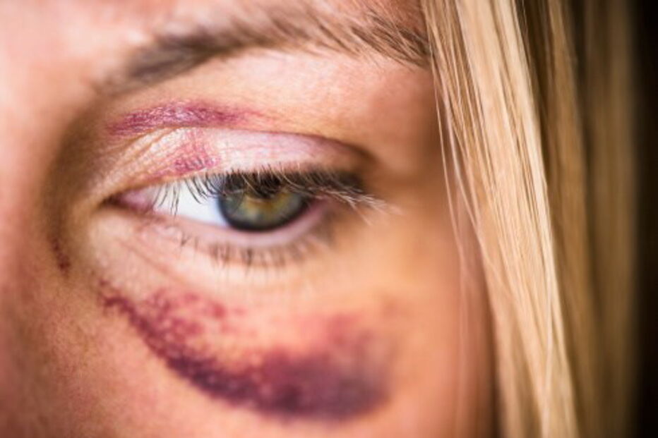 Vítimas de violência