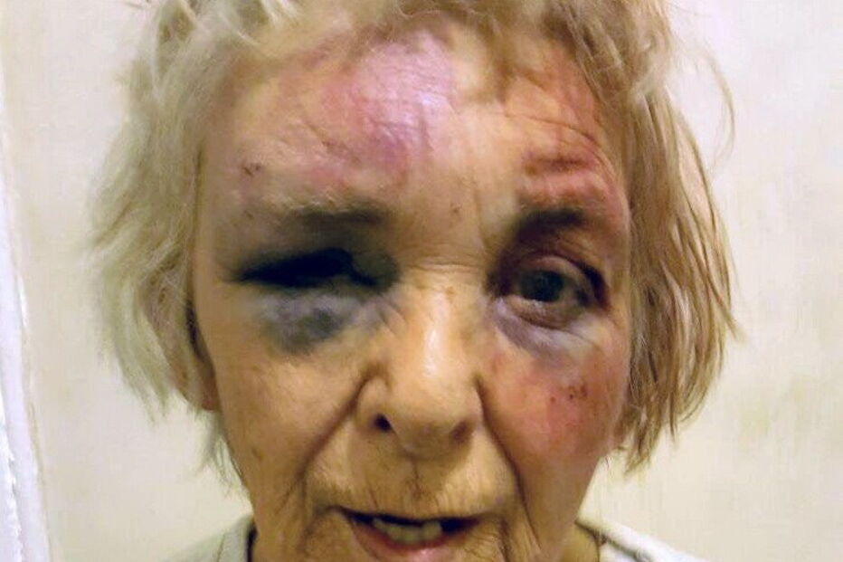 Mulher, idosa, espancamento, violência, Londres, Inglaterra