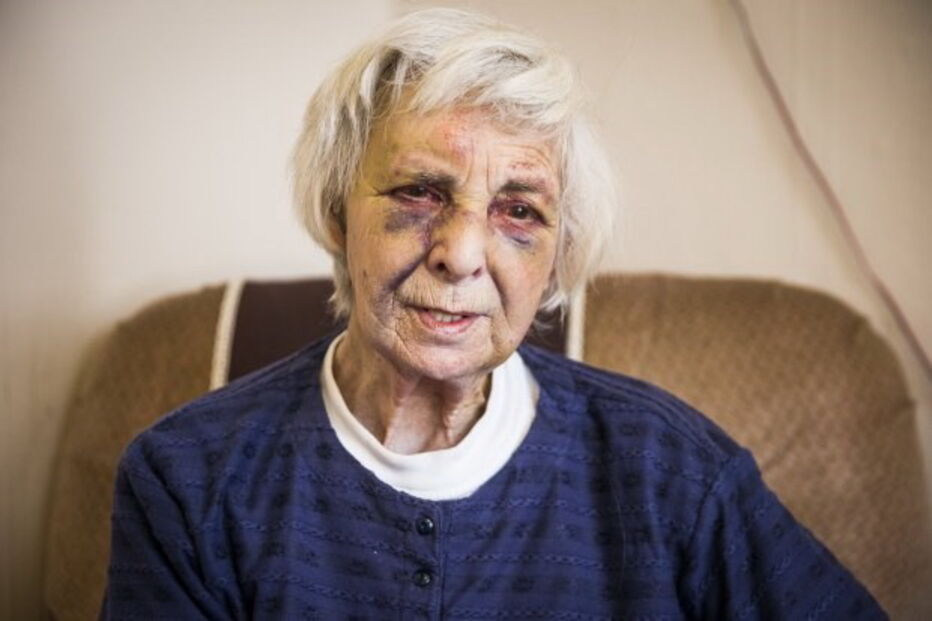 Idosa foi brutalmente espancada