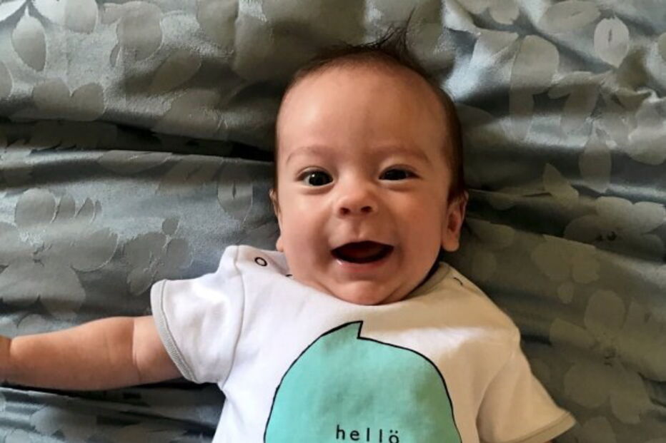 Casal foi obrigado a sacrificar gémeos siameses para salvar o filho, Thomas