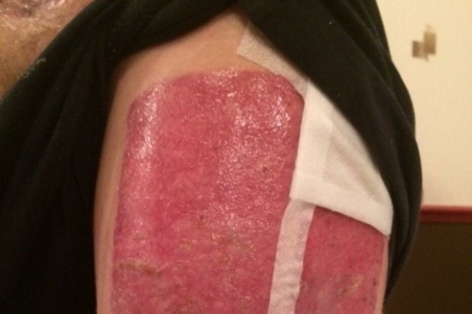 Antony teve que ser sujeito a uma série de operações nos últimos 12 meses