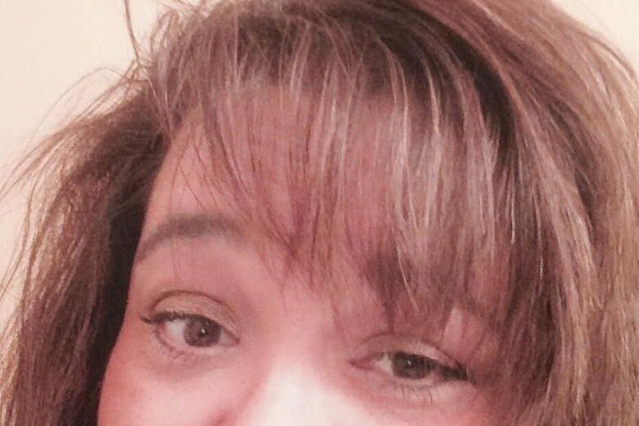 Lisa detetou uma mancha escura na unha da cliente