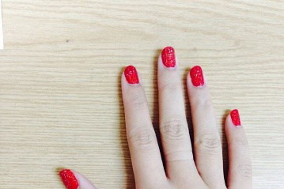 Lisa detetou uma mancha escura na unha da cliente