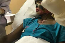 Atsede foi atacada com ácido pelo marido