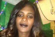 Atsede foi atacada com ácido pelo marido