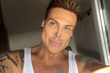 Neven Ciganovic, de 45 anos, ficou com uma ereção permanente após cirurgia ao nariz