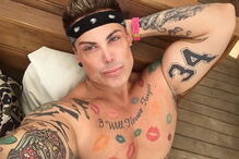 Neven Ciganovic, de 45 anos, ficou com uma ereção permanente após cirurgia ao nariz