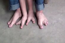 Chang Chang nasceu com apenas dois dedos em cada pé