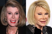 2017-09-19_12_12.23 Joan Rivers.PNG