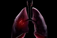 Doenças respiratorias crónicas