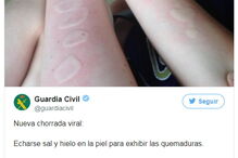 Jovens queimados com sal e gelo no novo desafio da Internet