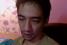 Arslan Valeev, encantador de serpentes, mostrou-se a ser mordido por uma cobra