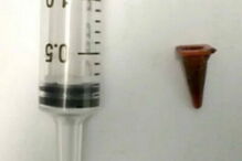 Sobrevive com brinquedo no pulmão durante 40 anos