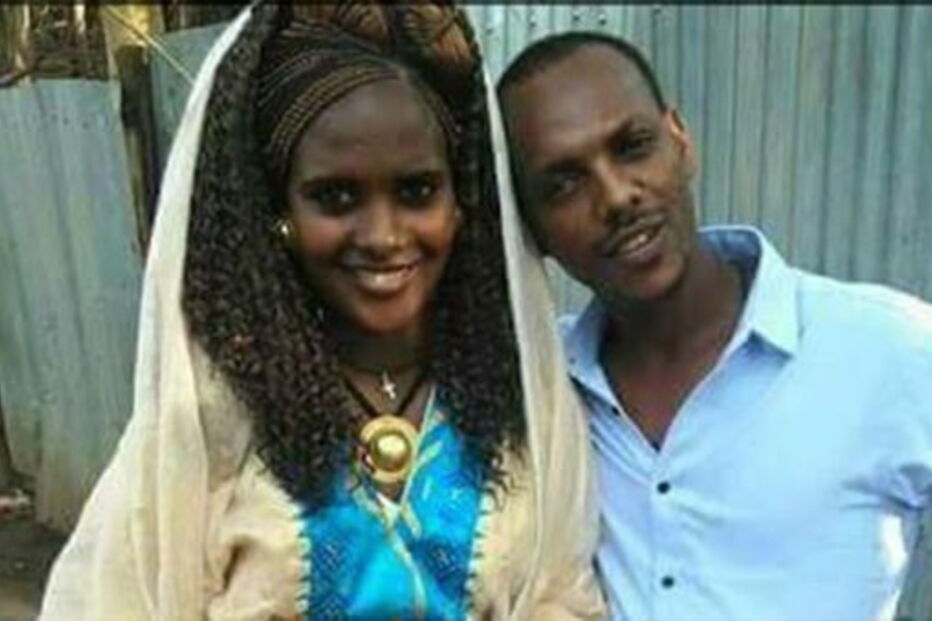 Atsede foi atacada com ácido pelo marido