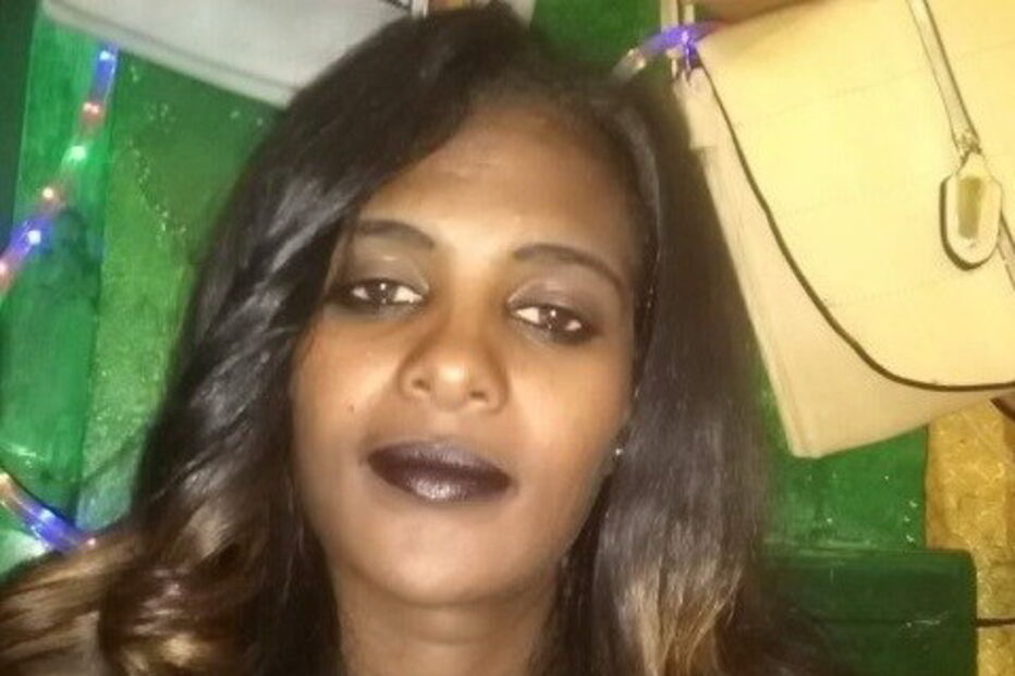 Atsede foi atacada com ácido pelo marido