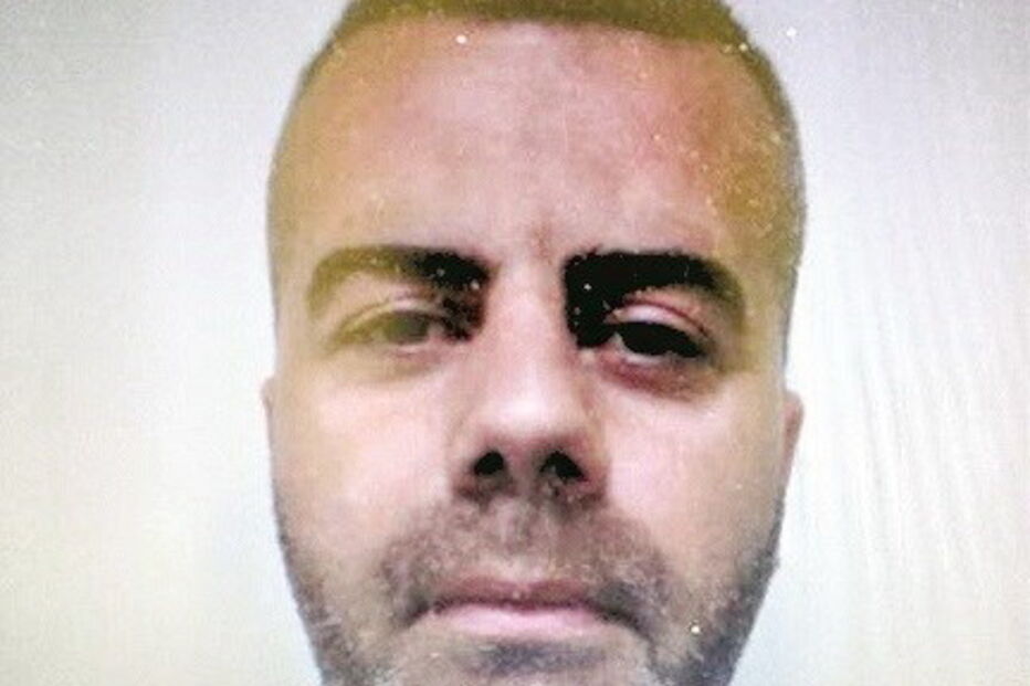 Nordahl Lelendais está em prisão preventiva, depois de ser encontrado ADN de menina desaparecida em França  