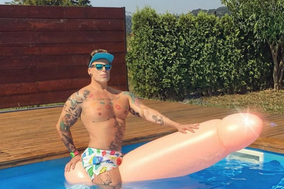 Neven Ciganovic, de 45 anos, ficou com uma ereção permanente após cirurgia ao nariz