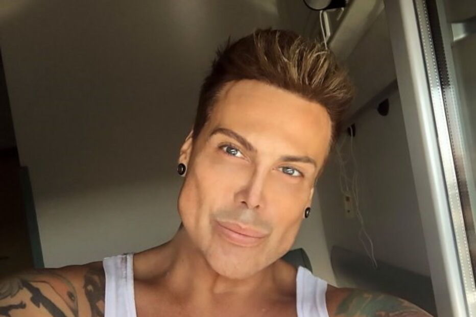 Neven Ciganovic, de 45 anos, ficou com uma ereção permanente após cirurgia ao nariz