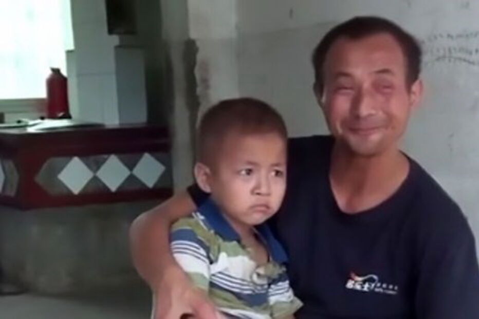 Chang Chang nasceu com apenas dois dedos em cada pé