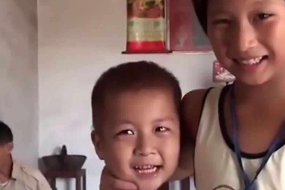 Chang Chang nasceu com apenas dois dedos em cada pé