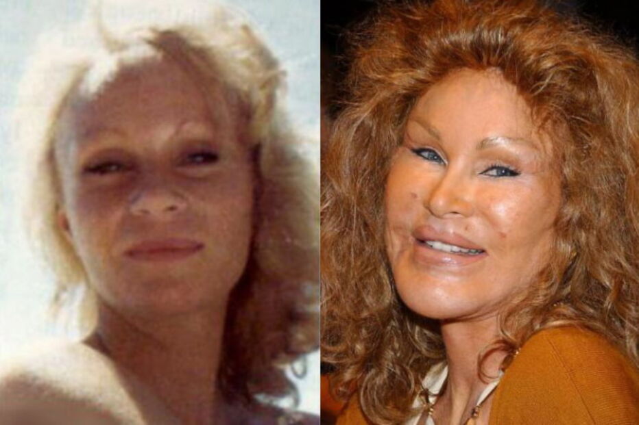 2017-09-19_12_12.24 Jocelyn Wildenstein.PNG