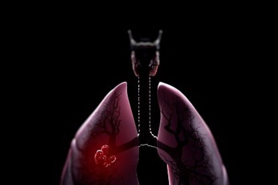 Doenças respiratorias crónicas