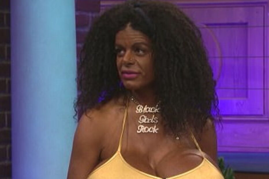 Modelo com “os maiores seios da Europa” escurece tom de pele