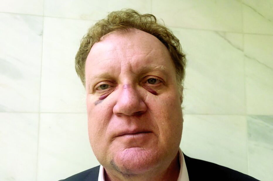 Advogado, António, colaço, agredido