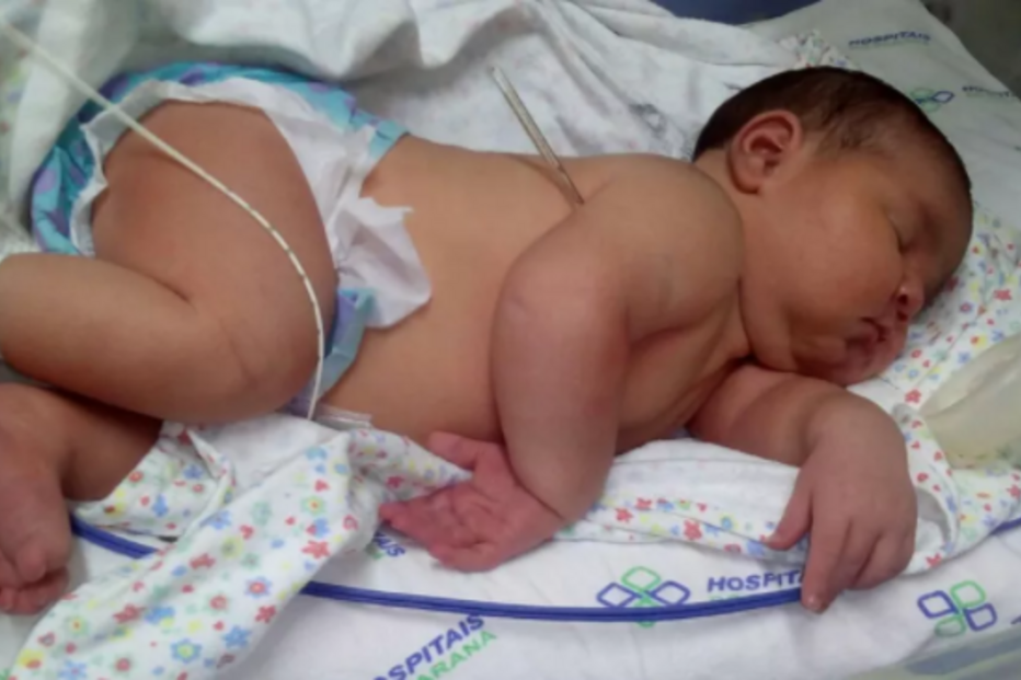 Maira Cristina Trevisan, Brasil, Gabrielly Ferreira, Paraná, questões sociais, saúde, bebé, gravidez, excesso de peso, criança, maternidade, parto, cesariana