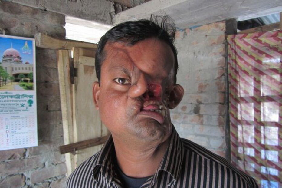 Homem fica com rosto desfigurado após sofrer ataque de tigre