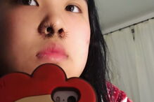 Bloggers de moda e gurus de beleza aderem à moda das extensões de pêlos do nariz