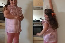 Menina teve a menstruação aos quatro anos e agora passa pela menopausa