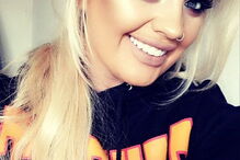 Euromilionária Jane Park já gastou 75 mil euros em cirurgias plásticas