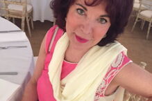 Stella garante que a aplicação de urina é responsável pela saúde da sua pele