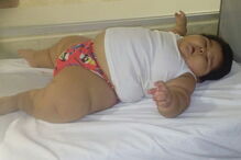 Luís Manuel tem 10 meses e pesa 30 quilos