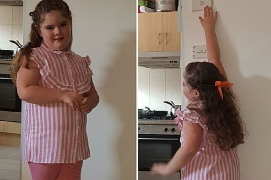 Menina teve a menstruação aos quatro anos e agora passa pela menopausa