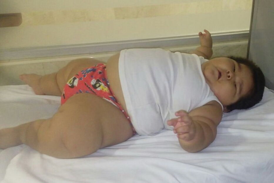 Luís Manuel tem 10 meses e pesa 30 quilos