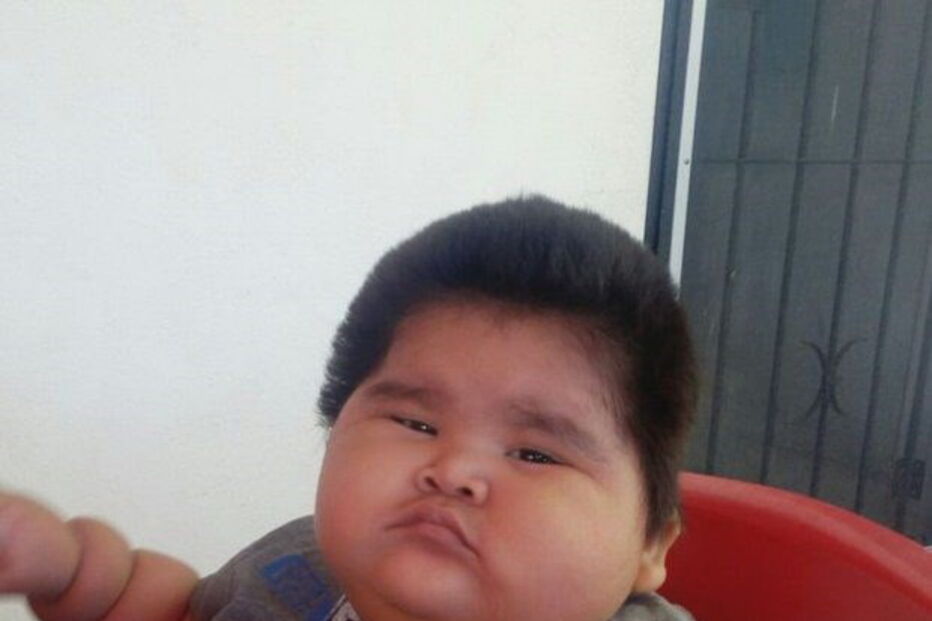 Luís Manuel tem 10 meses e pesa 30 quilos