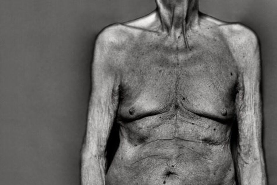 Idosa nua espanta ladrão